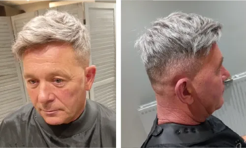 Hair Replacement System - FG MAN