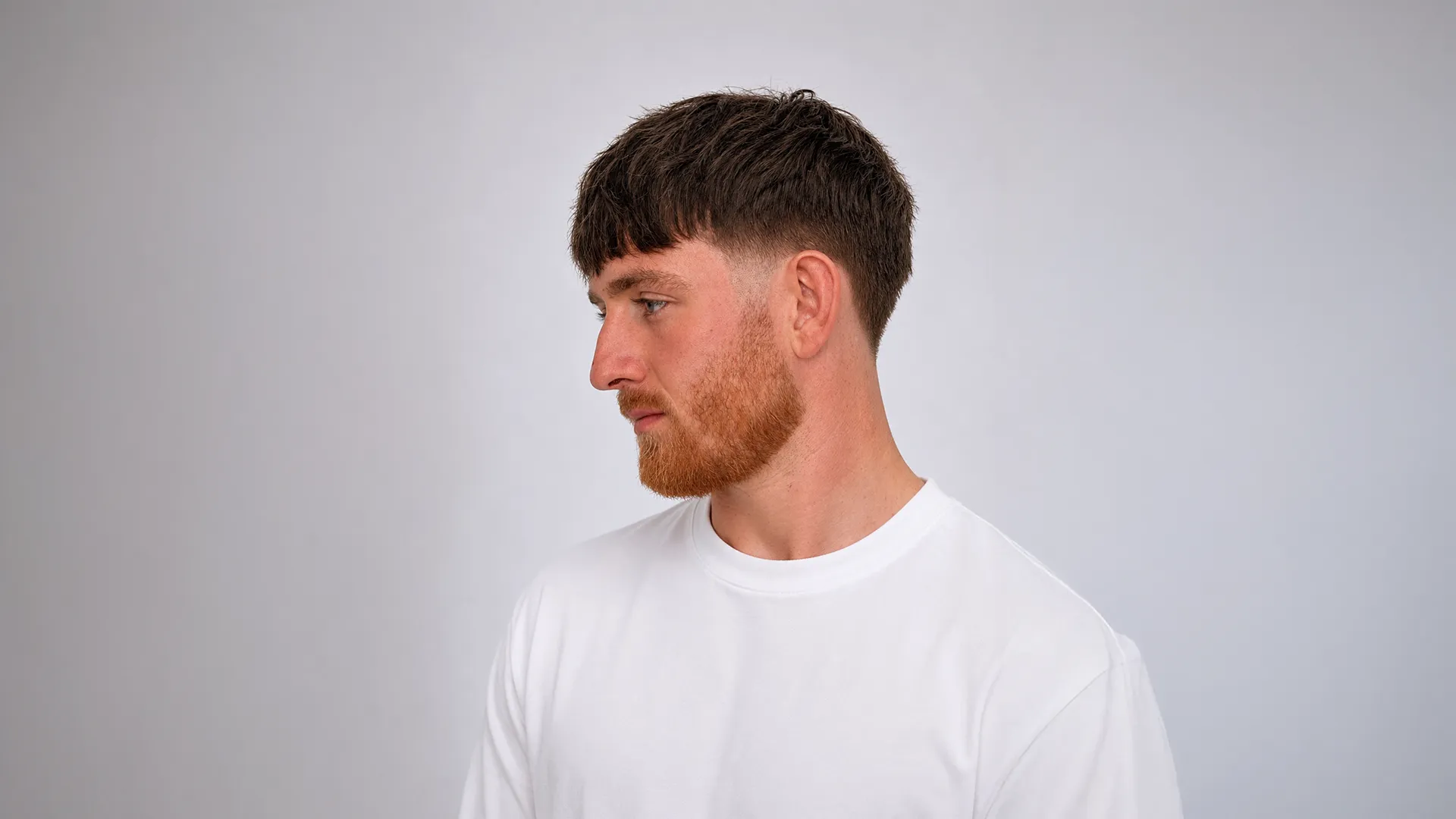 Hair Replacement System - FG MAN